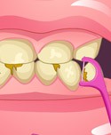 Bad Teeth Makeover