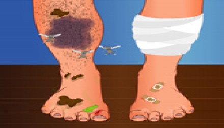 Smelly feet surgery