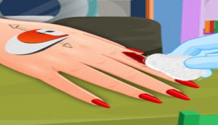 Manicure after injury